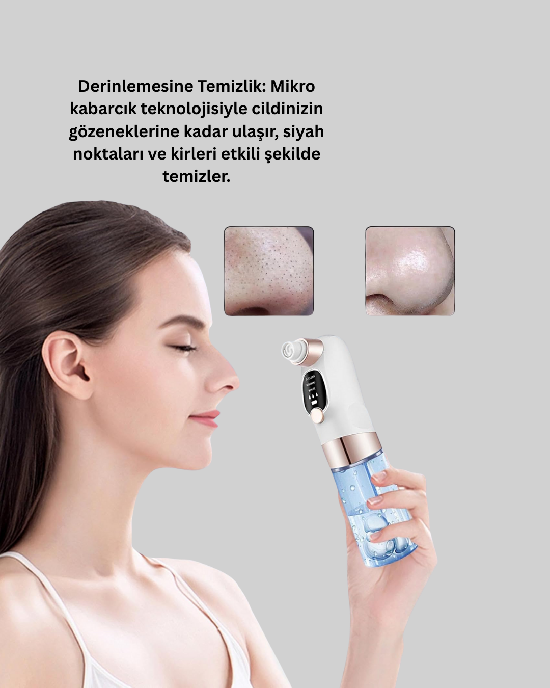 Çok Fonksiyonlu Cilt Bakım Cihazı – Siyah Nokta, Gözenek ve Akne Temizleyici